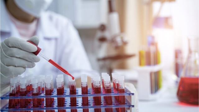 Corona-Symtome erkennen: Geruchsverlust kündigt sich schon vorher an