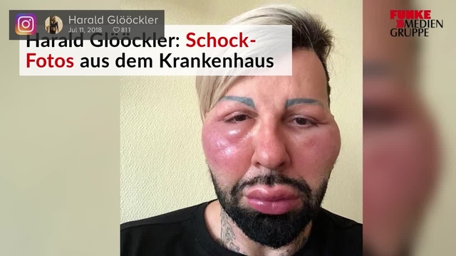 Harald Glööckler: Schock-Fotos aus dem Krankenhaus