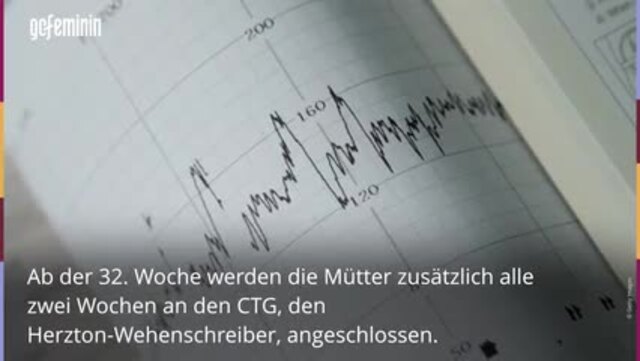 Schwangerschaft: Ab welcher SSW kann man den Babybauch sehen?