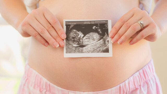 Harmony Test in der Schwangerschaft: Kosten, Ablauf und Erfahrungen