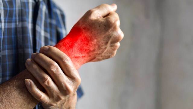 Mausarm: Was hilft gegen die Schmerzen?