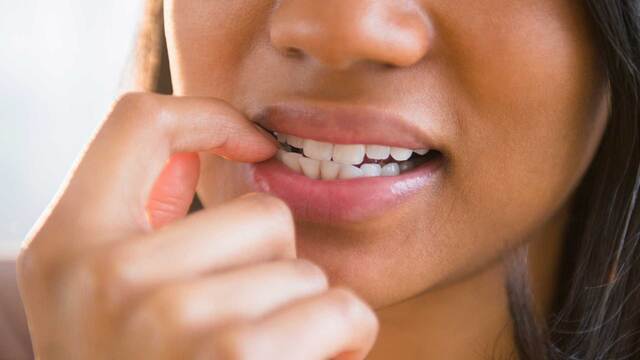 Fingern&auml;gel kauen: Erste Hilfe beim Abgew&ouml;hnen mit diesen einfachen Tipps