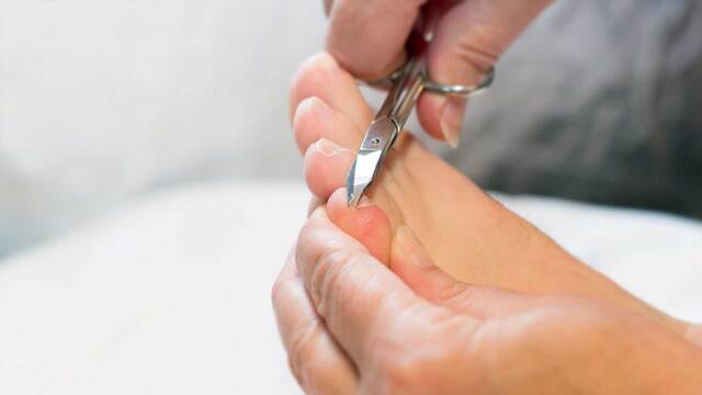 Fu&szlig;pflege: Das sind die gr&ouml;&szlig;ten Fehler bei der Pedik&uuml;re